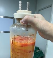 襄阳水动力吸脂手术要做多久？